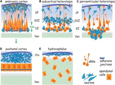 Adherens Junctions: Guardians of Cortical Development